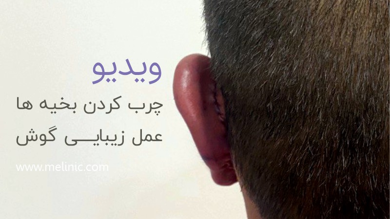 نحوه چرب کردن بخیه ها بعد از عمل زیبایی گوش
