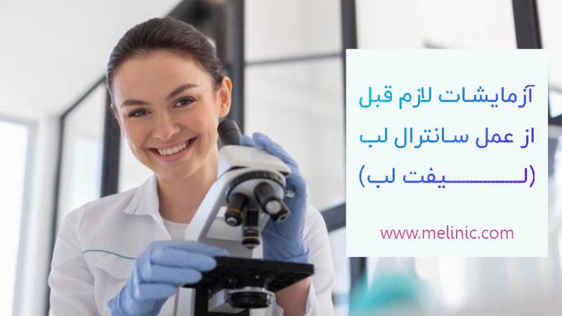 آزمایش قبل از سانترال لب