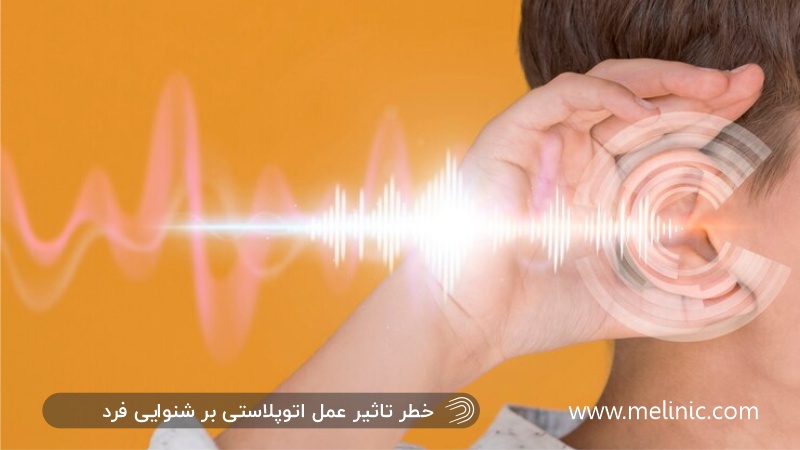 خطر تاثیر اتوپلاستی بر شنوایی