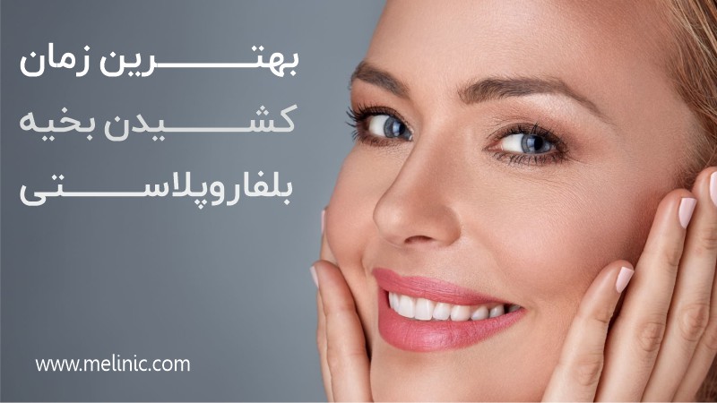 بهترین زمان کشیدن بخیه های بلفاروپلاستی