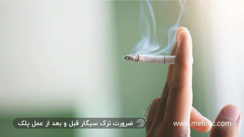ضرورت کاهش مصرف سیگار قبل و بعد از عمل بلفاروپلاستی