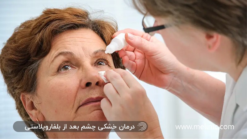 درمان خشک شدن چشم بعد از بلفاروپلاستی