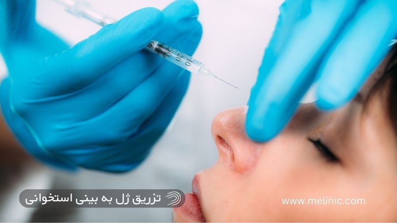 تزریق ژل به بینی استخوانی