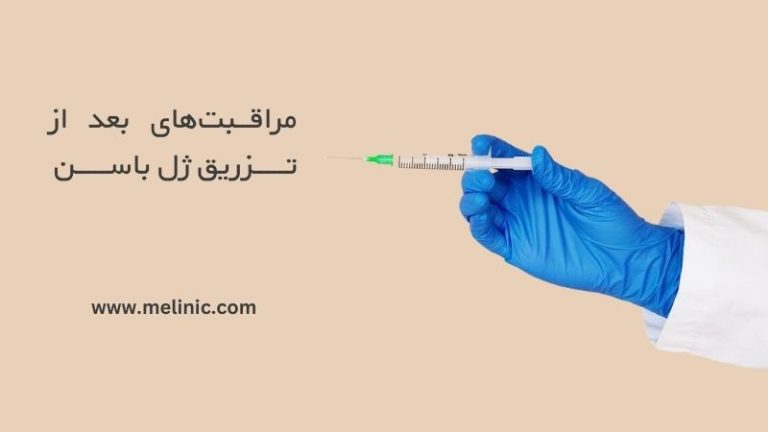 مراقبت های بعد از تزریق ژل باسن