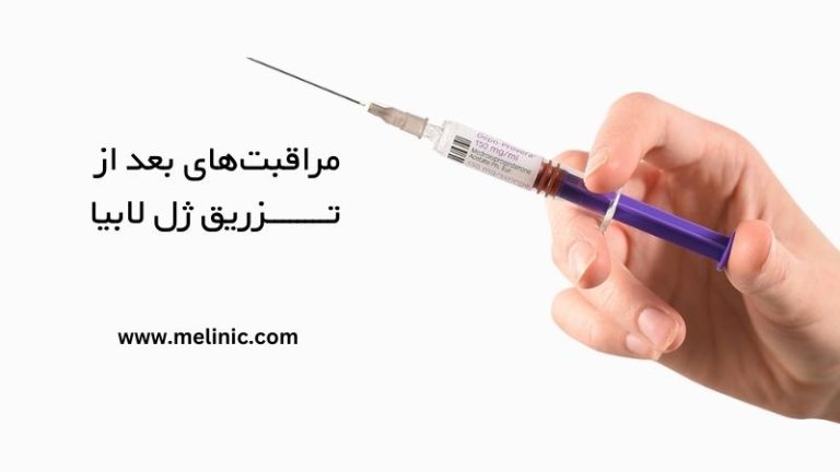 مراقبت‌های بعد از تزریق ژل لابیا