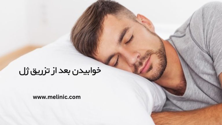 خوابیدن بعد از تزریق ژل