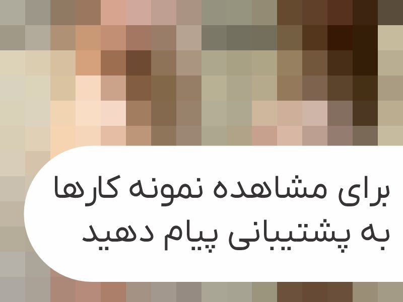 body-filler-portfolio-13